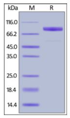 Human IL-1RL1, Fc Tag on SDS-PAGE under reducing (R) condition. The gel was stained overnight with Coomassie Blue. The purity of the protein is greater than 95%.